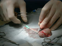 Donor Kidney Flush