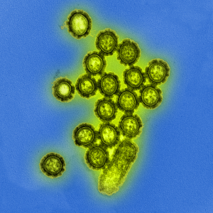 H1N1 influenza virus particles