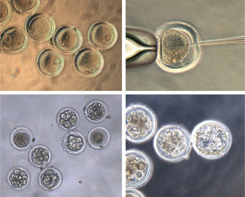 Egg cells harvested from Mauritian cynomolgus macaques (top left) were fertilized (top right) and injected with CRISPR gene editing materials to insert a genetic mutation that cured two men of HIV in the last decade