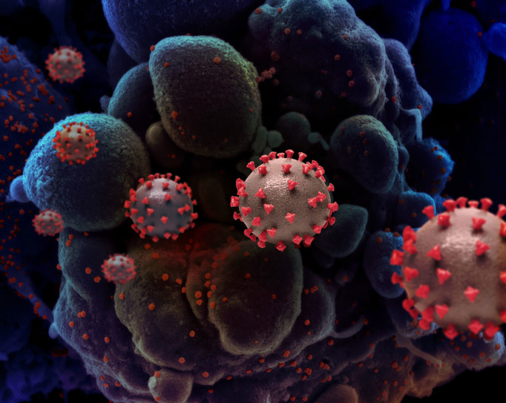 Creative rendition of SARS-COV-2 virus particles. Credit: National Institute of Allergy and Infectious Diseases, NIH