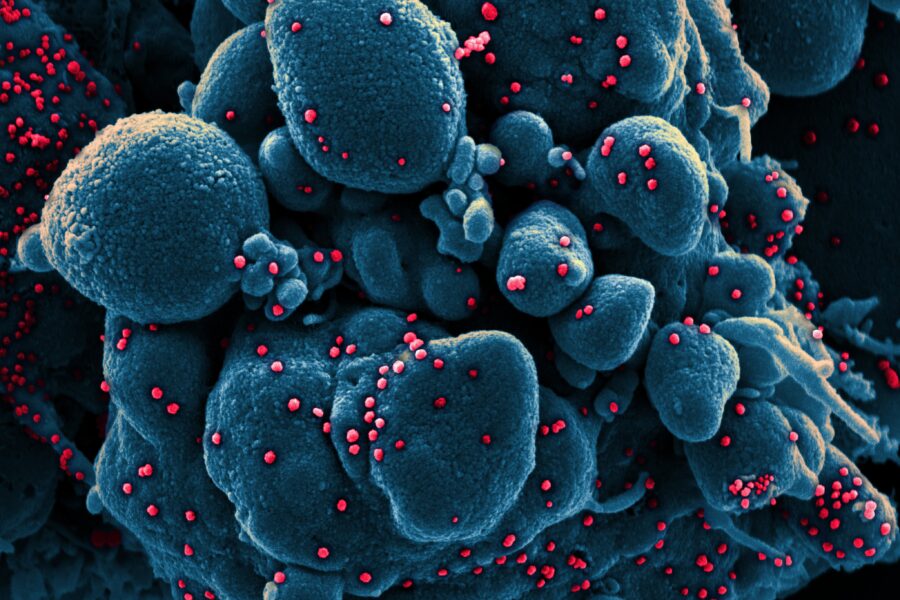 Colorized scanning electron micrograph of an apoptotic cell (blue) infected with SARS-COV-2 virus particles (red), isolated from a patient sample. Image captured at the NIAID Integrated Research Facility (IRF) in Fort Detrick, Maryland. Credit: National Institute of Allergy and Infectious Diseases, NIH