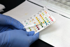 A test strip used to determine changes in a patient's urine as part of a urinalysis