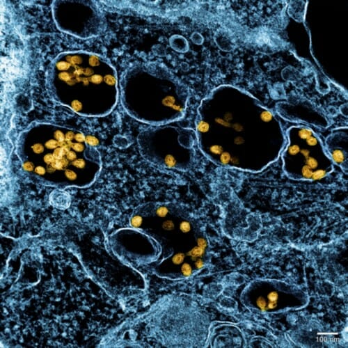  A color-enhanced electron micrograph of SHFV growing in cell culture. NIAID INTEGRATED RESEARCH FACILITY AT FORT DETRICK
